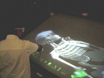 9.  A researcher working with a 3D human skeletal structure